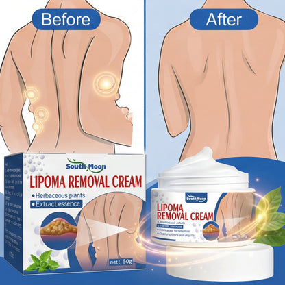 South Moon Lipoma Removal Cream(IMPORTED)