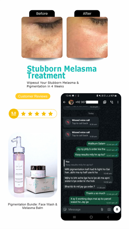 Face Balm For Melasma