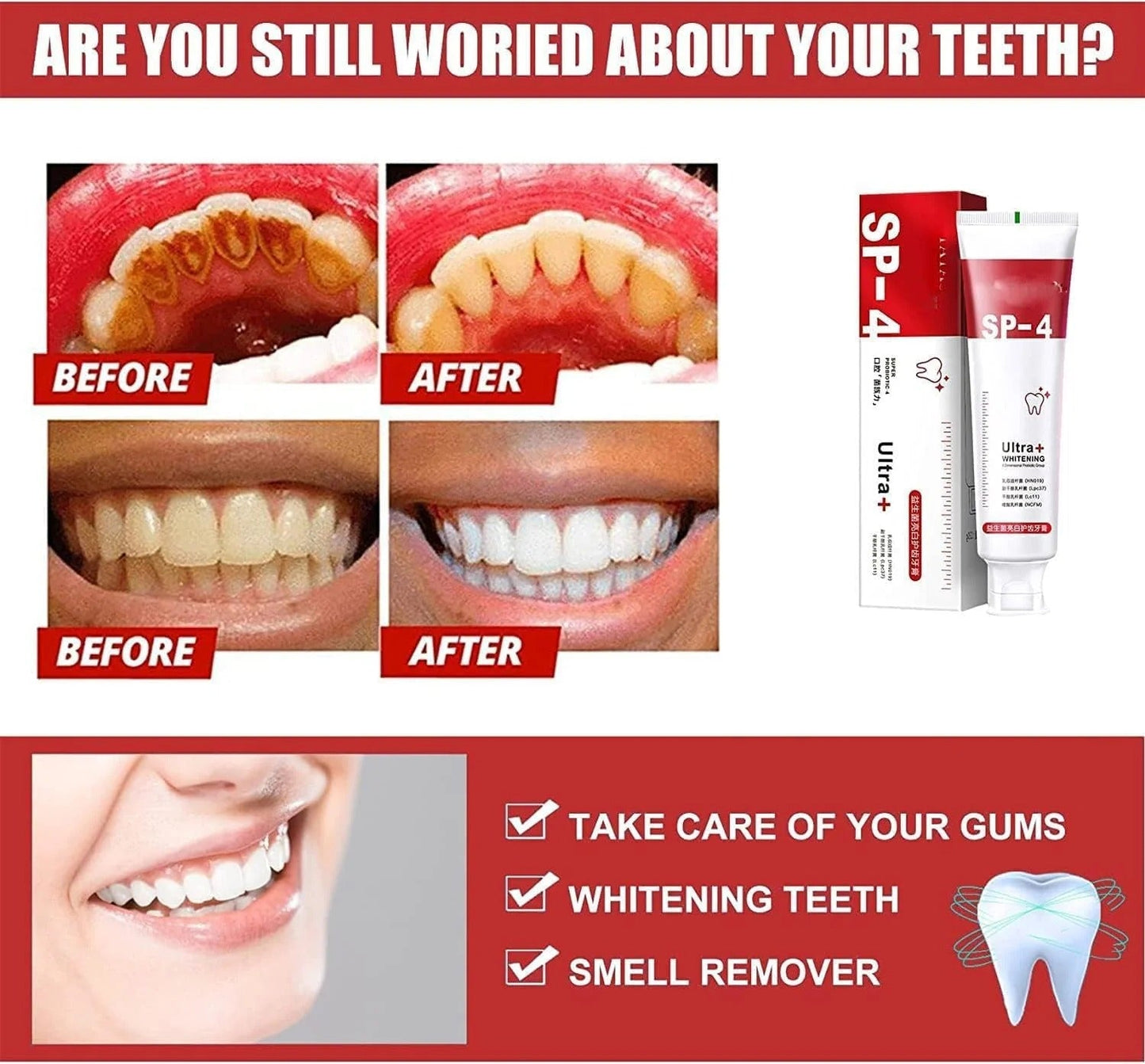 Yayashi SP-4 Probiotic Whitening Toothpaste